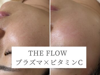 ザ フロウ(THE flow)/開き毛穴をプラズマでケア