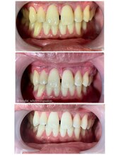 ブライト 心斎橋本店(bright)/効果写真