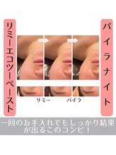 ラ ルミエール(La Lumiere)/小顔になりたい方は是非お試し！