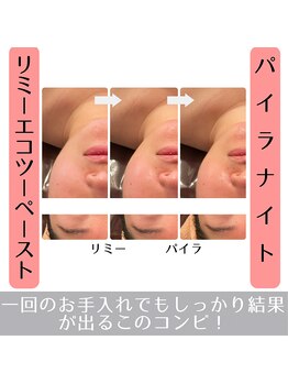 ラ ルミエール(La Lumiere)/小顔になりたい方は是非お試し！