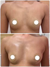 ルナグランデ 心斎橋店(Luna grande.)/カップ数UP