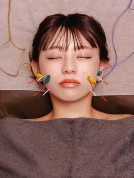 シー バイ カリスタ 吉祥寺店(C by CALISTA)の写真/【小顔リフトアップに特化したフェイシャル美容鍼】鍼で緩め、トリートメントでリラックス。理想の小顔に。