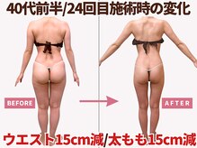 べモーレ 上本町 谷町九丁目(Bemolle)の雰囲気（丁寧なカウンセリングでお悩みが解決する通い方をご提案します☆）