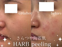 グランクウォーレ(Gran Cuore)/