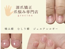 ネイルサロン アンド スクール グレースレディ(grace lady)
