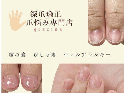 ネイルサロン アンド スクール グレースレディ(grace lady)の写真