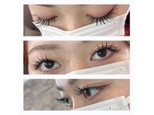 ルーフの雰囲気(学生証のご提示で500円off/中学生までの脱毛キッズメニューあり)