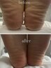 【フットケア】プロヒール(かかと角質ケア+膝下全体トリートメント付)60分