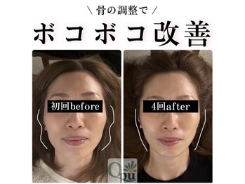 キュープ 高崎店(Qpu)の写真/リピート率9割！一度でも効果を実感できる小顔矯正専門サロン♪理想のフェイスラインへ◎
