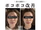 キュープ 高崎店(Qpu)の写真/リピート率9割！一度でも効果を実感できる小顔矯正専門サロン♪理想のフェイスラインへ◎