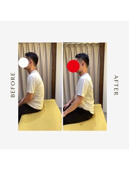 多摩 唐木田整体室/猫背・腰痛のビフォーアフター