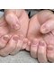 Mネイル 伏見店の写真/噛み爪・深爪・巻き爪のお悩みは、爪の健康を第一に考えるMネイルにお任せ★【噛み爪・深爪ケア3回¥27500】