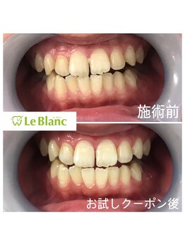ルブラン 奈良店(Le Blanc)/歯のお手入れしてますか？