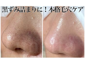 ルネッタ(Lunetta)