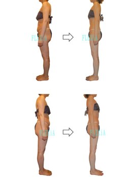 ハナン(Hanan)/ナノカレントで全身骨格矯正!