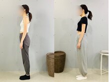 イレ 名古屋栄(ile)/週1回×6回で、猫背・巻き肩卒業