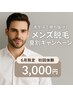 【初回限定先着5名様】メンズ脱毛夏割キャンペーン