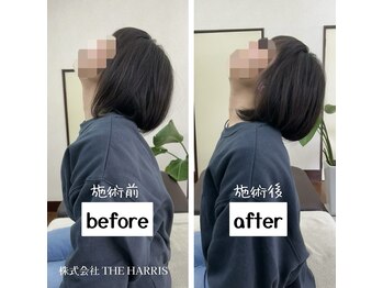 由利本荘整体院/施術ビフォーアフター（首）