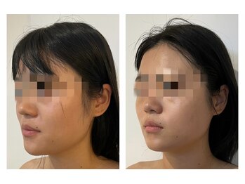 ペルナ(perna)/小顔×ラジオ派フェイシャル