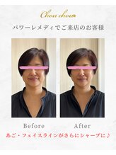 シュシュ(Chouchou)/パワーレメディ1回