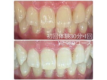 ホワイトニングルーム 横浜店(Whitening Room)/セルフホワイトニング/横浜