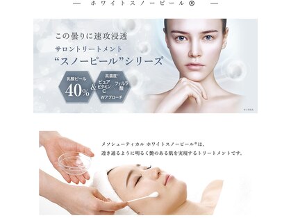 ベルーチェ(Beluce)の写真