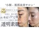 キュアリード(Cure_Lead)の写真