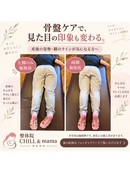 整体院チルアンドママ(CHILL&mama)の写真/産後の体型を変えたい！産後骨盤矯正で産前のズボンが履ける！体重は戻っても体型が戻らないママ達へ！！