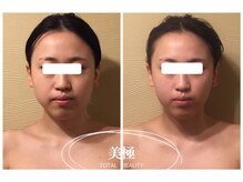 美極 銀座店/銀座/小顔コルギ/小顔矯正