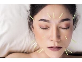 リアンドハリ(Rien’d Hari)/人気NO1究極のリフト美容鍼灸