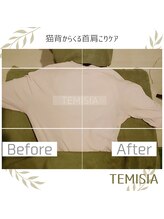テミシア(TEMISIA)/猫背ケアに