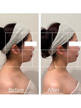 エステティックサロン ラ ベルタ(Esthetic Salon La Belta)/華奢みえコルギ