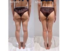 ローメル(LOWMEL)