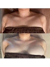 アイミーボーテ(Aime beaute)/バストアップ【デコルテ】