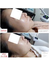 ミュー(Mieux)/特別な日の為に綺麗になれました