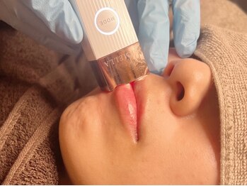 カプロ ボゥ(Capullo.Beau)の写真/【韓国発ルメラ】渡韓せずに本気の黒ずみ改善！脇、バストトップ、VIOデリケートゾーンも一度で完了★