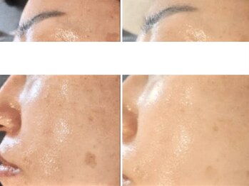 ソレイユ(Soleil)/透明感・ハリ