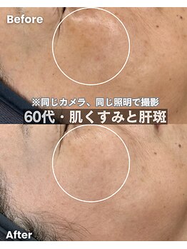 イデアーレ(ideale)/60代 ・ 感動の変化が!