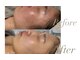 サロンドココ(Salon de coco)の写真