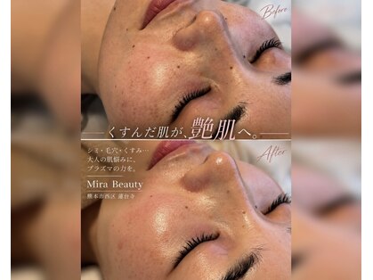 ミラビューティー(Mira Beauty)の写真