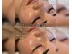 ミラビューティー(Mira Beauty)の写真