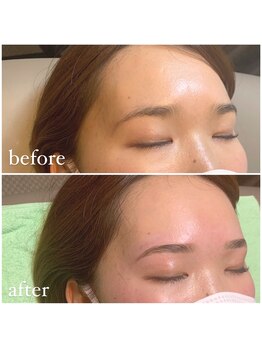 ミント アイラッシュ(mint)/