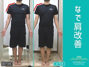 美骨矯正 ステキプロ(SUTEKI pro)/肩こり・巻肩・猫背改善・整体