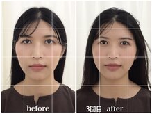 アキュモンド 渋谷院(acumond)/acumondコース初回と3回目の変化