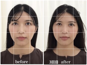 アキュモンド 渋谷院(acumond)/acumondコース初回と3回目の変化