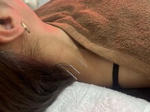 鍼灸院 はりエイト