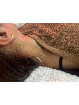 首・肩のつらさを改善したい