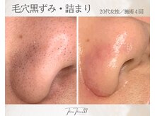 スリースリー(THREE THREE)/毛穴黒ずみ・詰まりケア