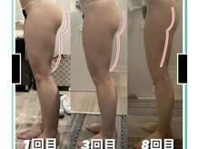 痩身革命 大宮店の雰囲気（【本格！短期集中】ブライダル1ヶ月でこの効果[痩身]）