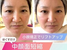 オリファインサンサン(Orefine33)